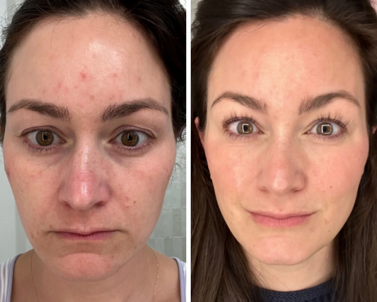 MASCARA FACIAL BEAUTY LOVERS